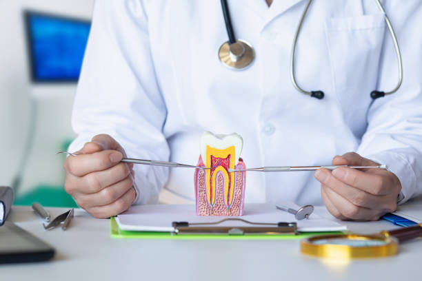 Best Emergency Dentist for Lost Fillings or Crowns in Brea, CA